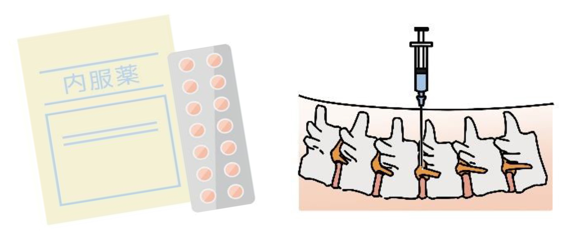 腰痛の治療法