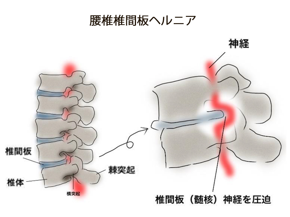 原因2