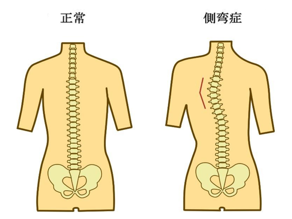 原因3