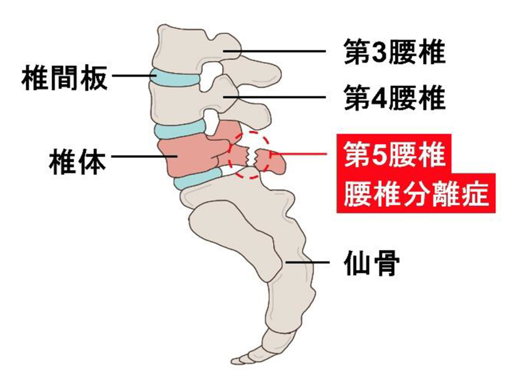 原因4