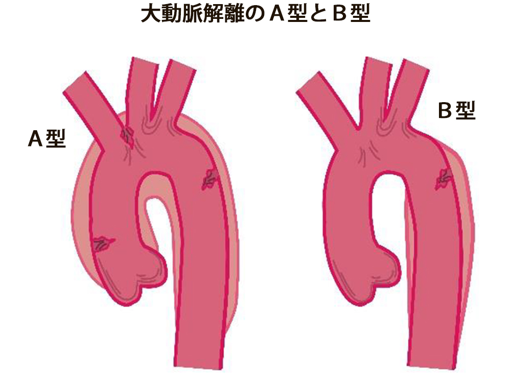 腰部以外に原因のあるもの1
