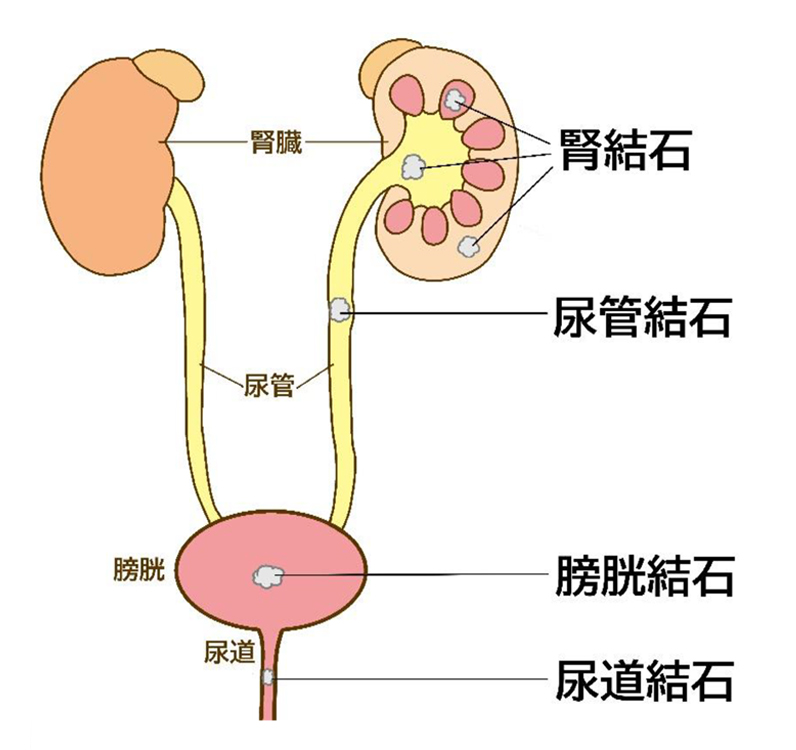 腰部以外に原因のあるもの2