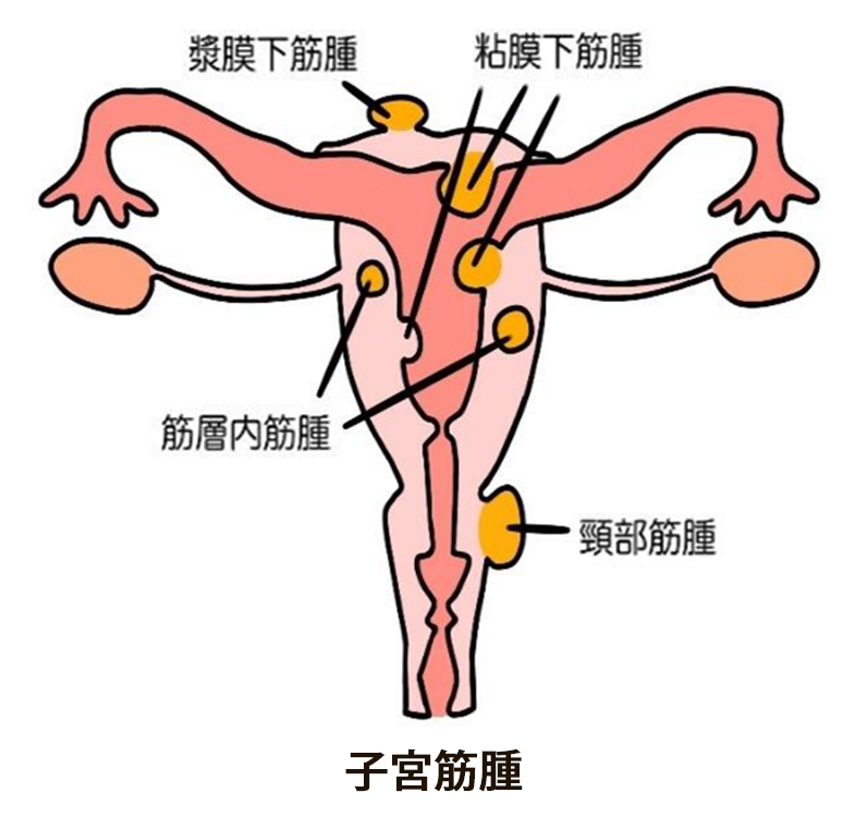 腰部以外に原因のあるもの3